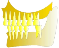 perte dent  dentiste marseille protheses dentaires